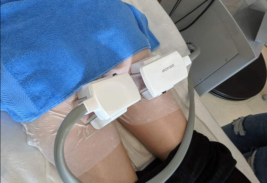 3D Lipo Cryolipolisys (Double Fat Freeze)