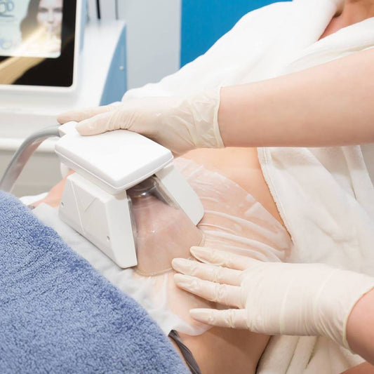 3D Lipo Cryolipolisys (single Fat Freeze)