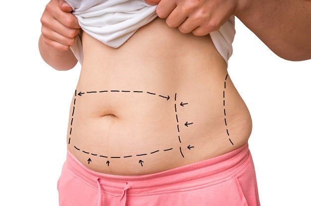 3D Lipo Cryo & Cavitation Stomach Package