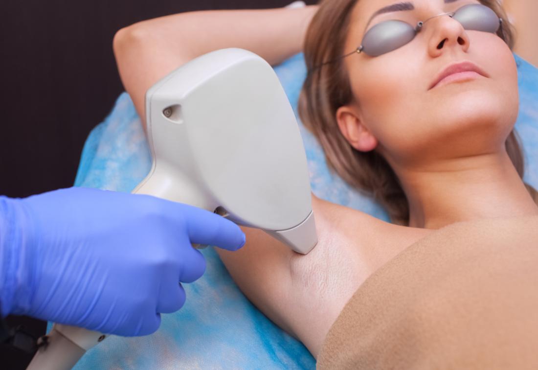 Laser hair removal Underarms course of 8