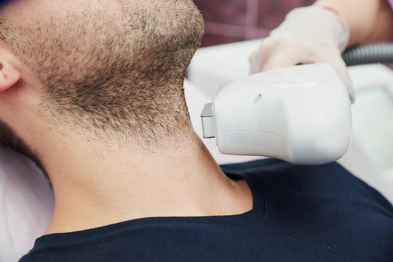 Laser Hair Removal Neck course of 8