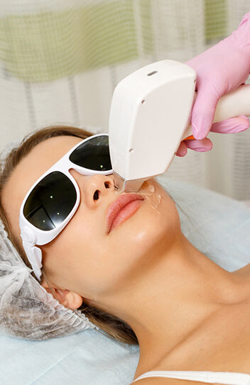 Laser hair removal Upper Lip and Chin course of 8