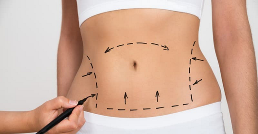 3D Lipo Non Surgical Tummy Tuck